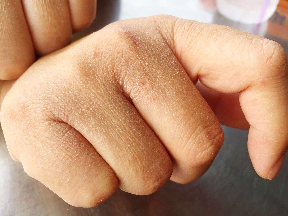 درمان خانگی خشکی پوست بدن: راهکارهای طبیعی و مؤثر