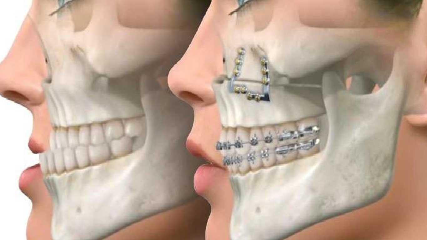 مقابله با ناهنجاری فک: راهکارهای مؤثر و درمانهای پیشرفته