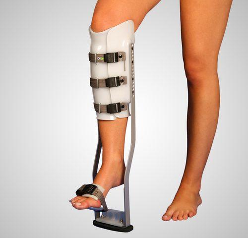 بهترین زمان مراجعه به پزشک ارتوپد بعد از آسیب های استخوانی و مفصلی